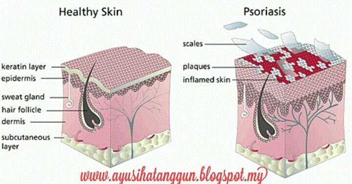 Sihat Itu Nikmat - HEALTH  BISNES  FAMILY: APA ITU 